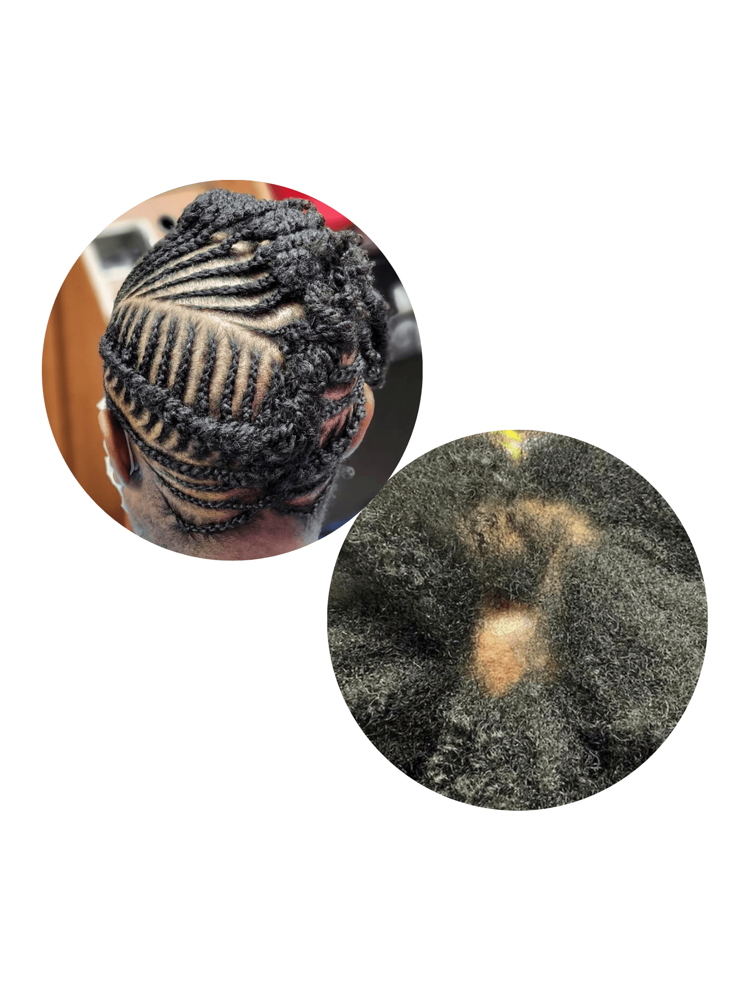 Hair Regrowth Solutions for Women
