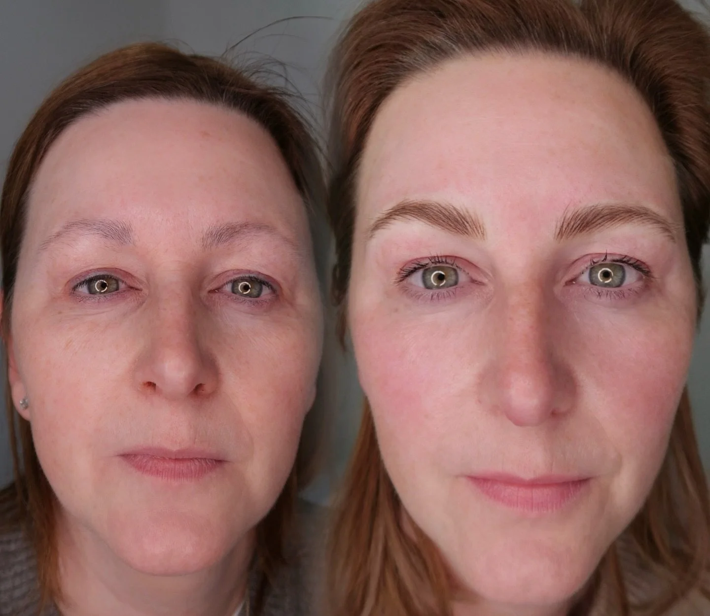 Your Face Deserves 110% - No Rushing, No Corners Cut

One thing that sets my services apart is how I choose to work. I only perform one new PMU procedure per day &mdash; and that&rsquo;s on purpose.

Each appointment typically takes around 3 hours, b