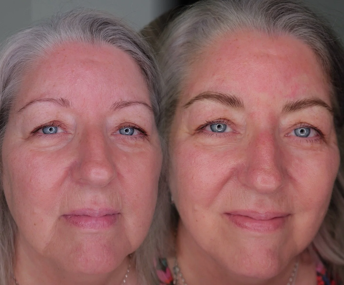 Hyper-realism eyebrow restoration for Donna 🫶🏻 We focused on rebuilding the lower brow line and restoring density lost through years of over-plucking. In these cases, precise brow design and pigment selection are essential to ensure the restoration