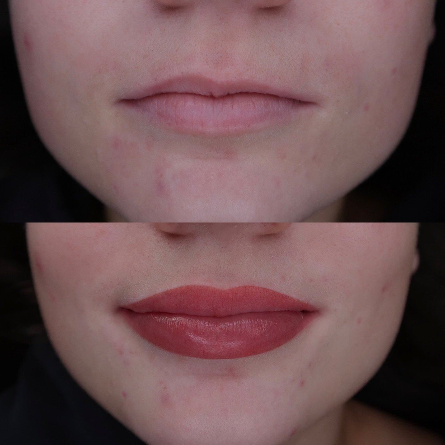 This was a beautifully challenging and deeply rewarding lip blush case for my client Kaitlin, who came to me seeking restoration of pigment on her left upper lip to help correct a long standing asymmetry. Being able to support young women to feel mor