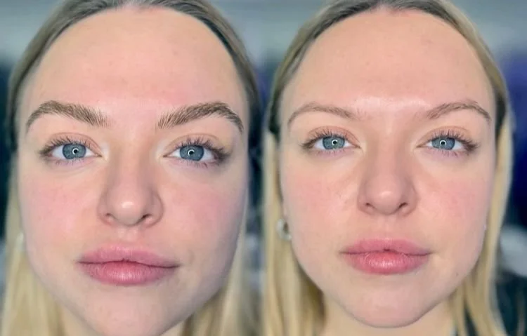 My Personal Brow Journey