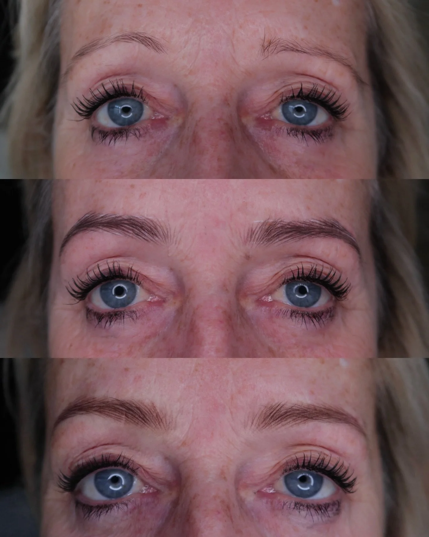 A Few Millimetres That Took Years Off Her Face