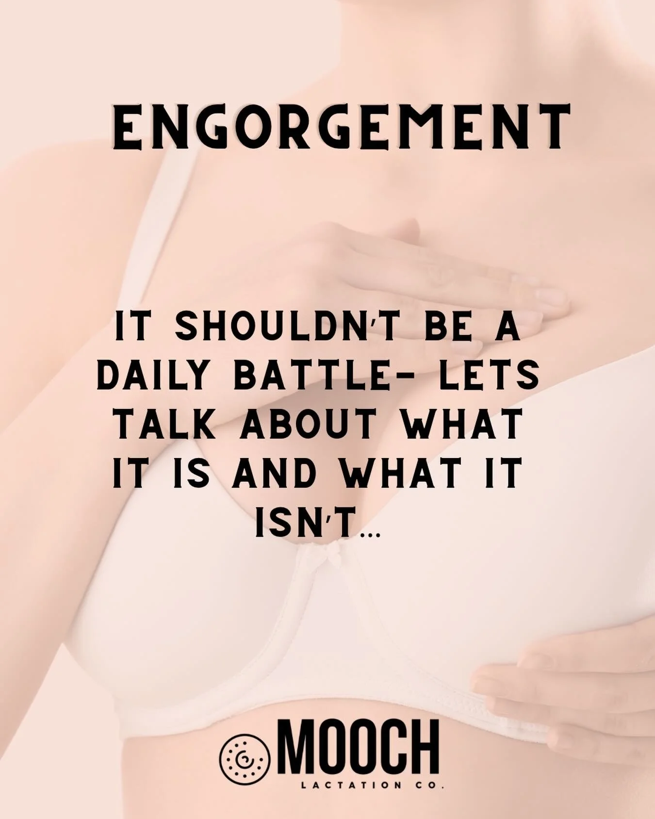 💟 Breast engorgement can happen when the breasts become overly full which causes swelling, firmness, and pain during breastfeeding. It commonly happens in the first few days after birth when milk production increases, but it can also happen later if