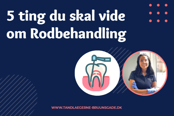 5 ting du skal vide om Rodbehandling