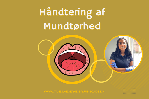 Håndtering af Mundtørhed