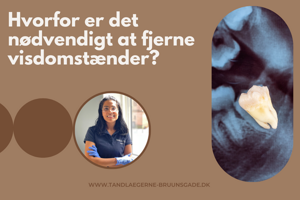 Hvorfor er det nødvendigt at fjerne visdomstænder?