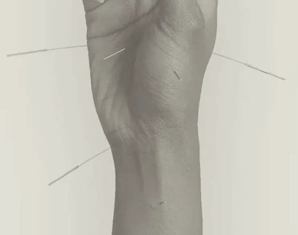 the turning:  A Seasonal Restorative Yoga &amp; Acupuncture Experience