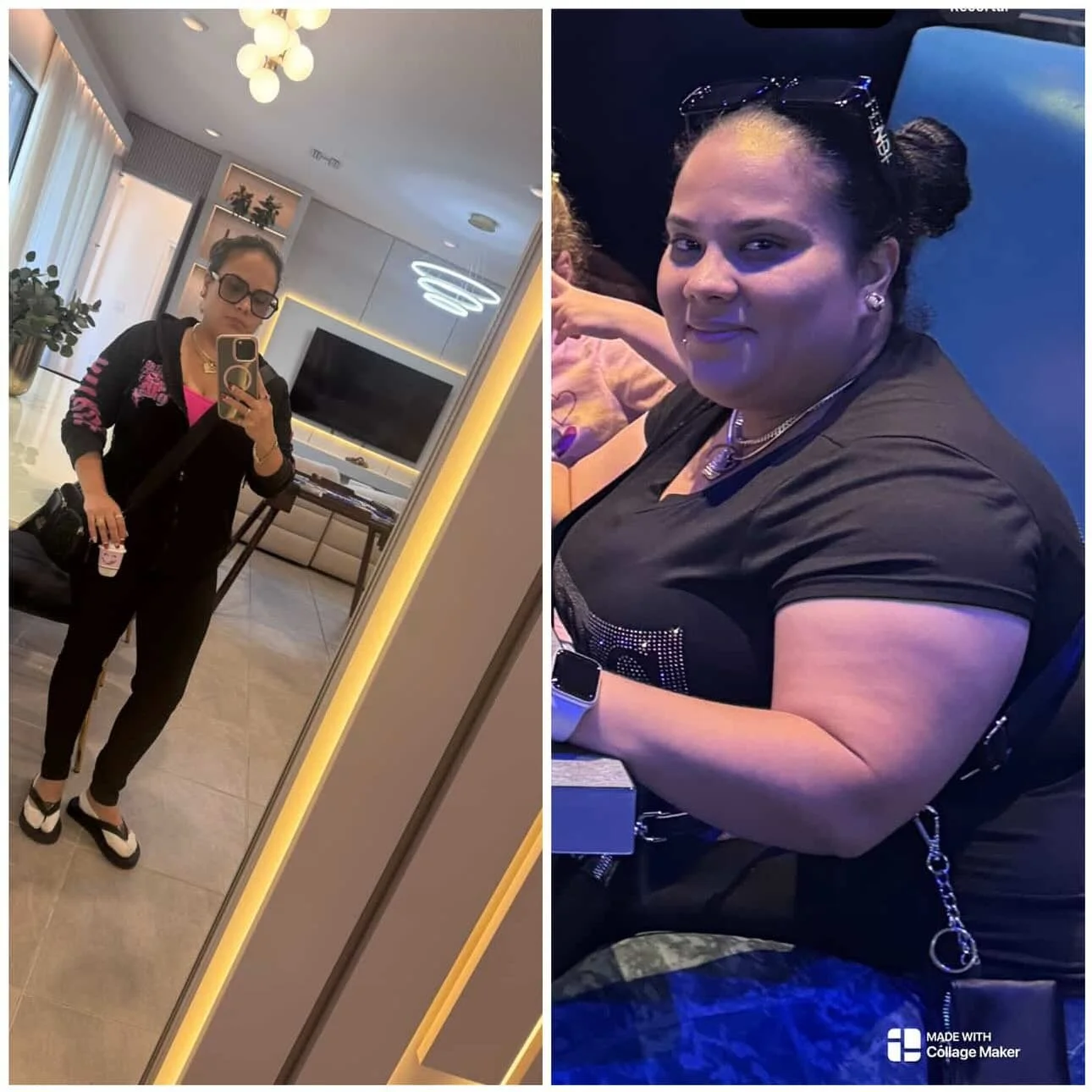 Celebrating our patients success!! 🙌👏🎉

Celebrando el &eacute;xito de nuestras pacientes!! 🙌👏🎉

#transformationthursday #bariatricsurgery
#generalsurgery
#minimallyinvasivesurgery
#metabolicsurgery
obesitymedicine