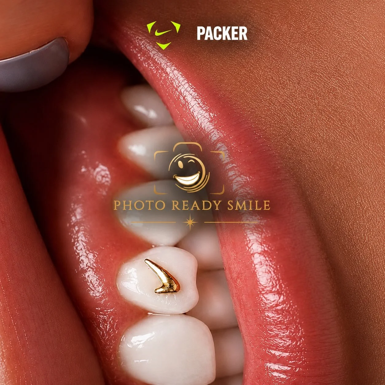 Client showing her teeth gem
