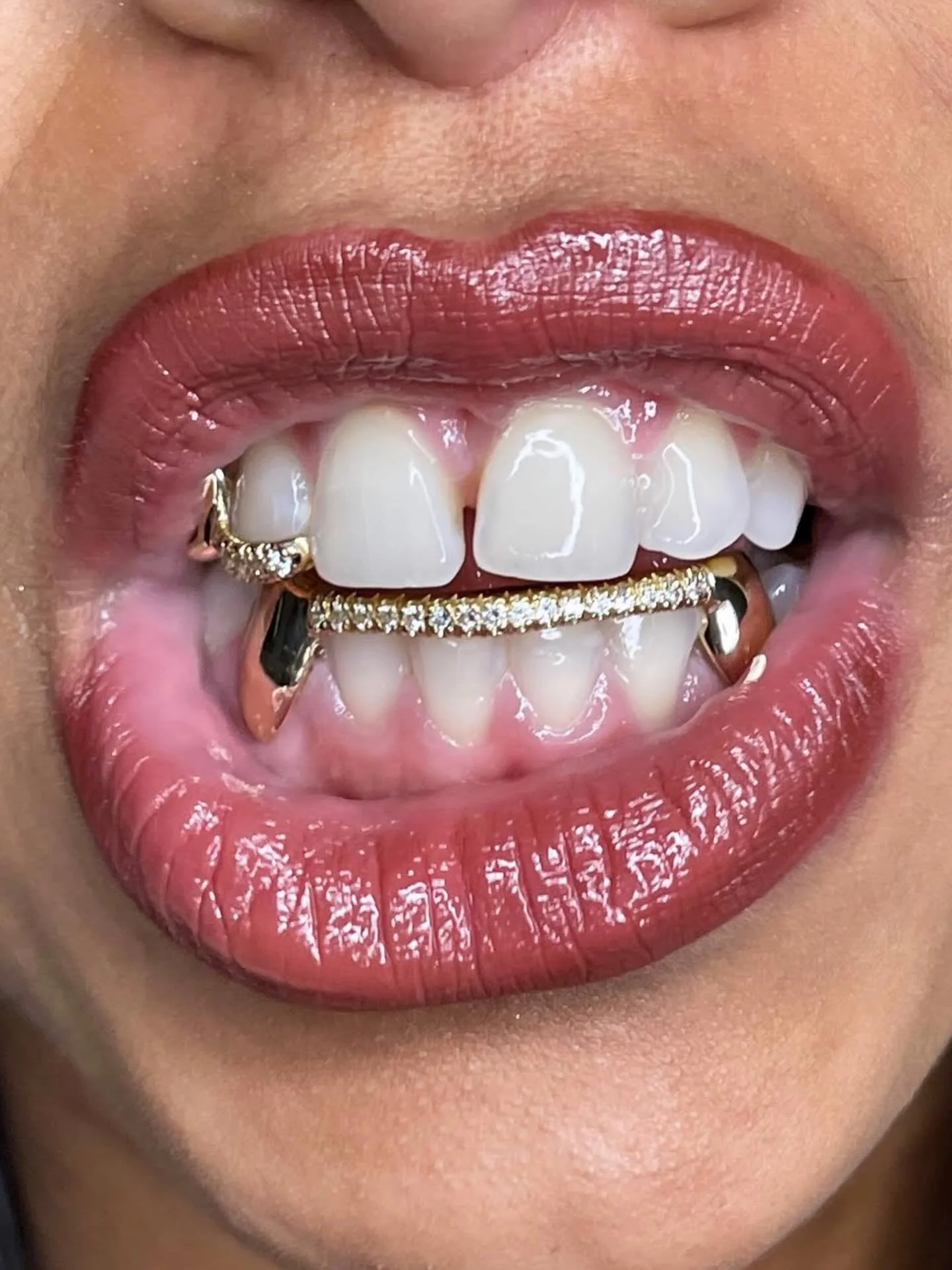 Clients showing her teeth gem