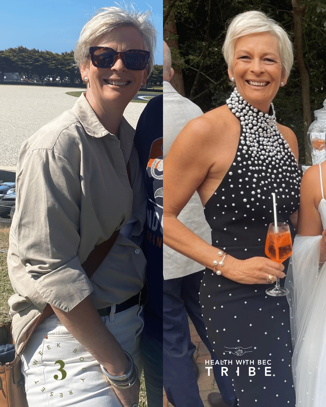 Lucille Before & After