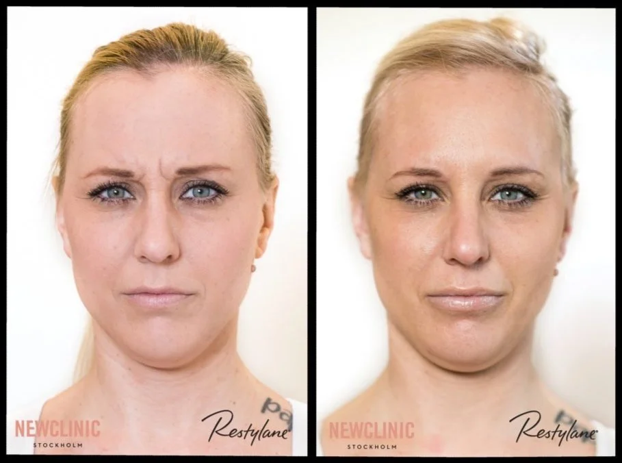 11spread-botox-1024x789.jpg