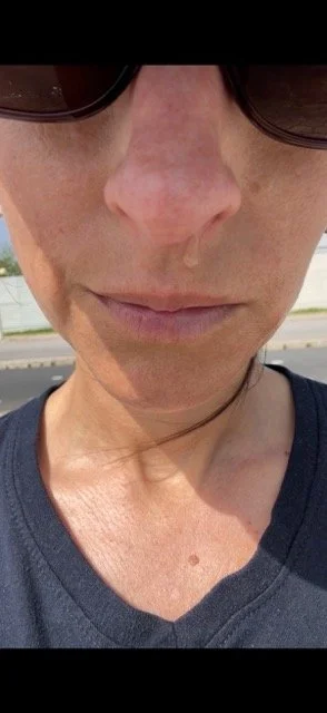 constant nasal drip