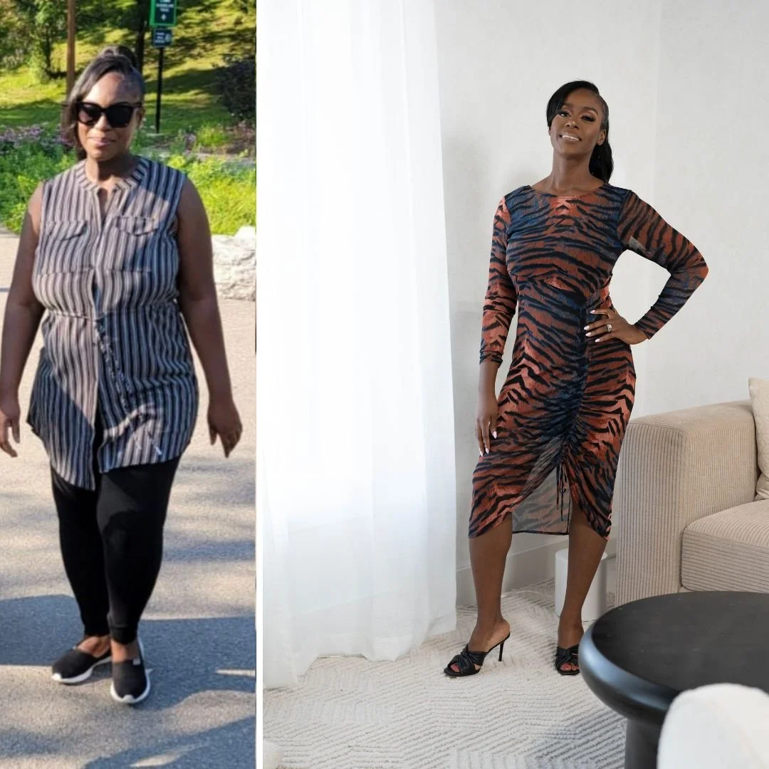 Dr Phyllis before and after photo - Sculpted and Sizzling