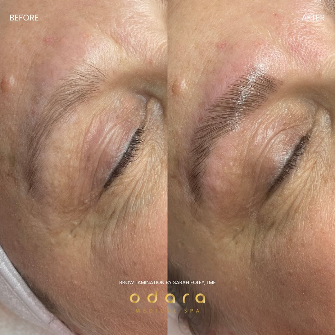 Brow laminations are so in for 2024 🤍
Results by @sarah.odaramedspa 

#browlamination #esthetician #beforeandafter