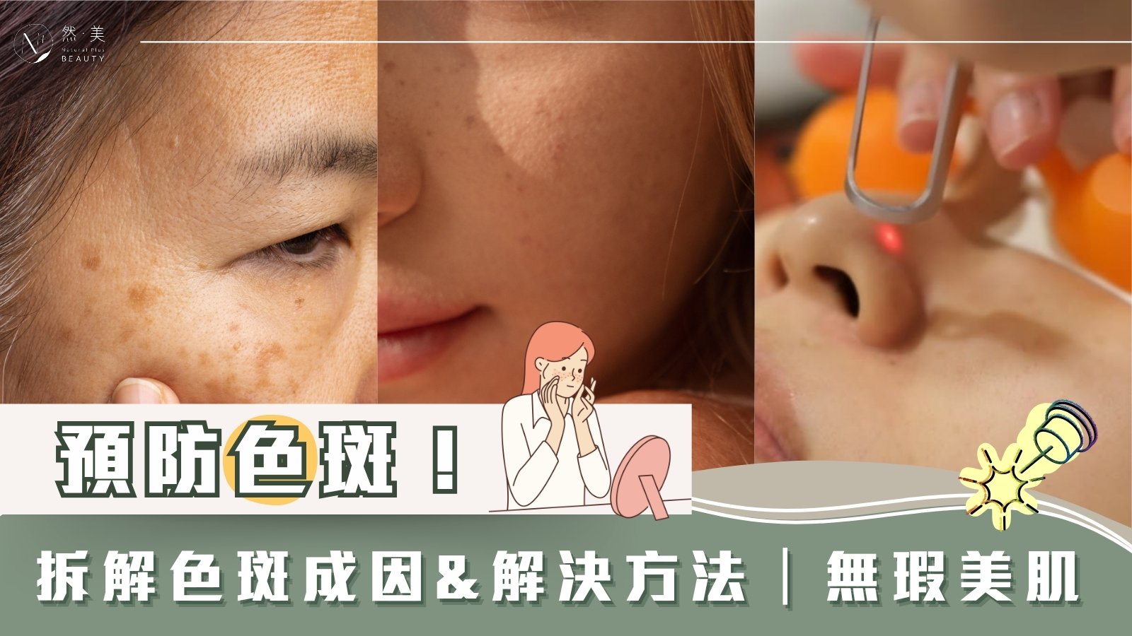 拆解色斑成因、預防解決方法