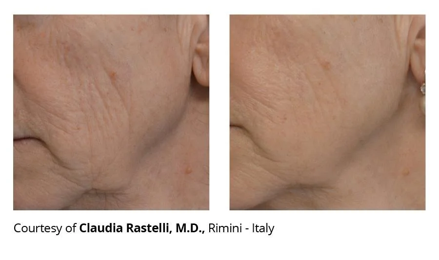 getbeforeafter 1.jfif