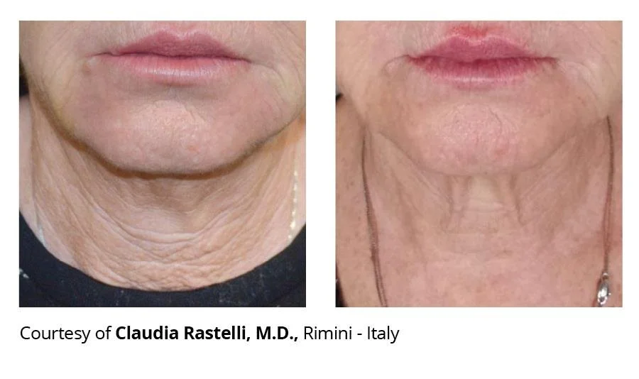 getbeforeafter 2.jfif