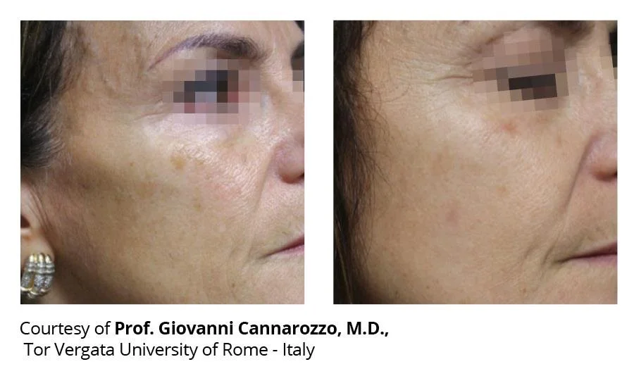 getbeforeafter 3.jfif