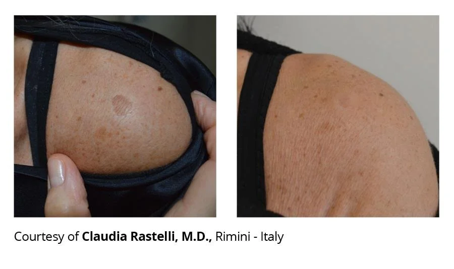 getbeforeafter 4.jfif