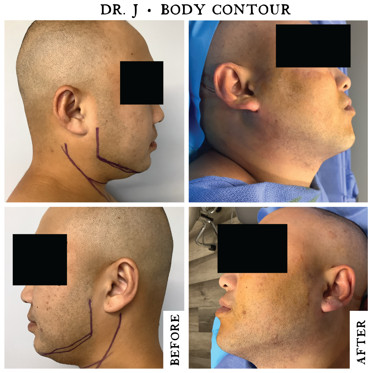 NECK6.png