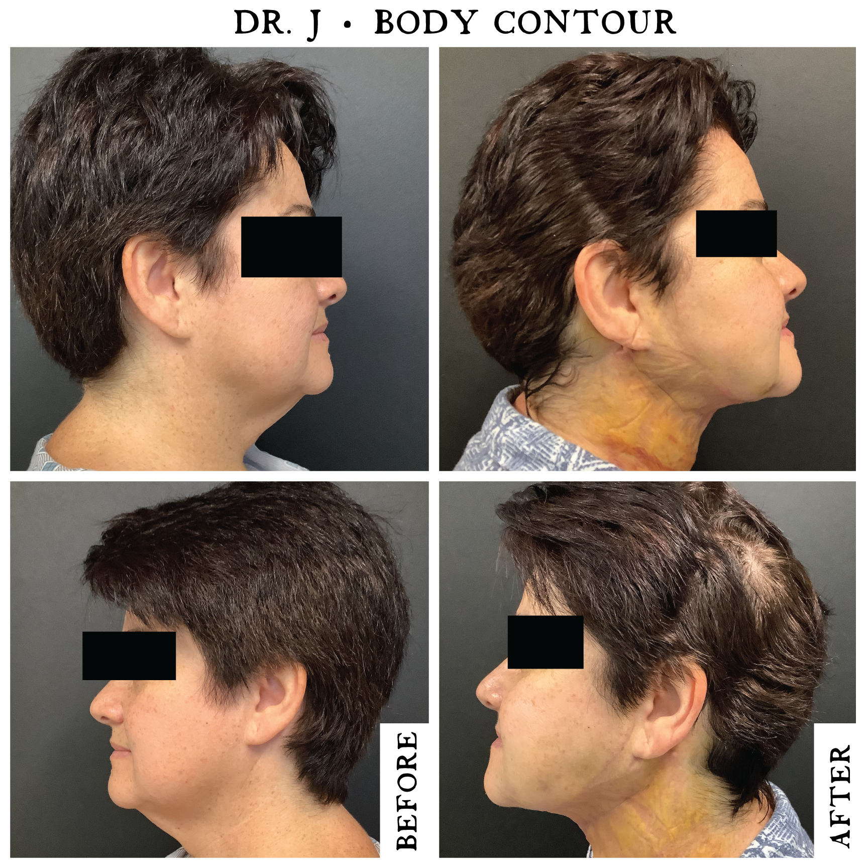 B-&-A-Case-2-Neck.png