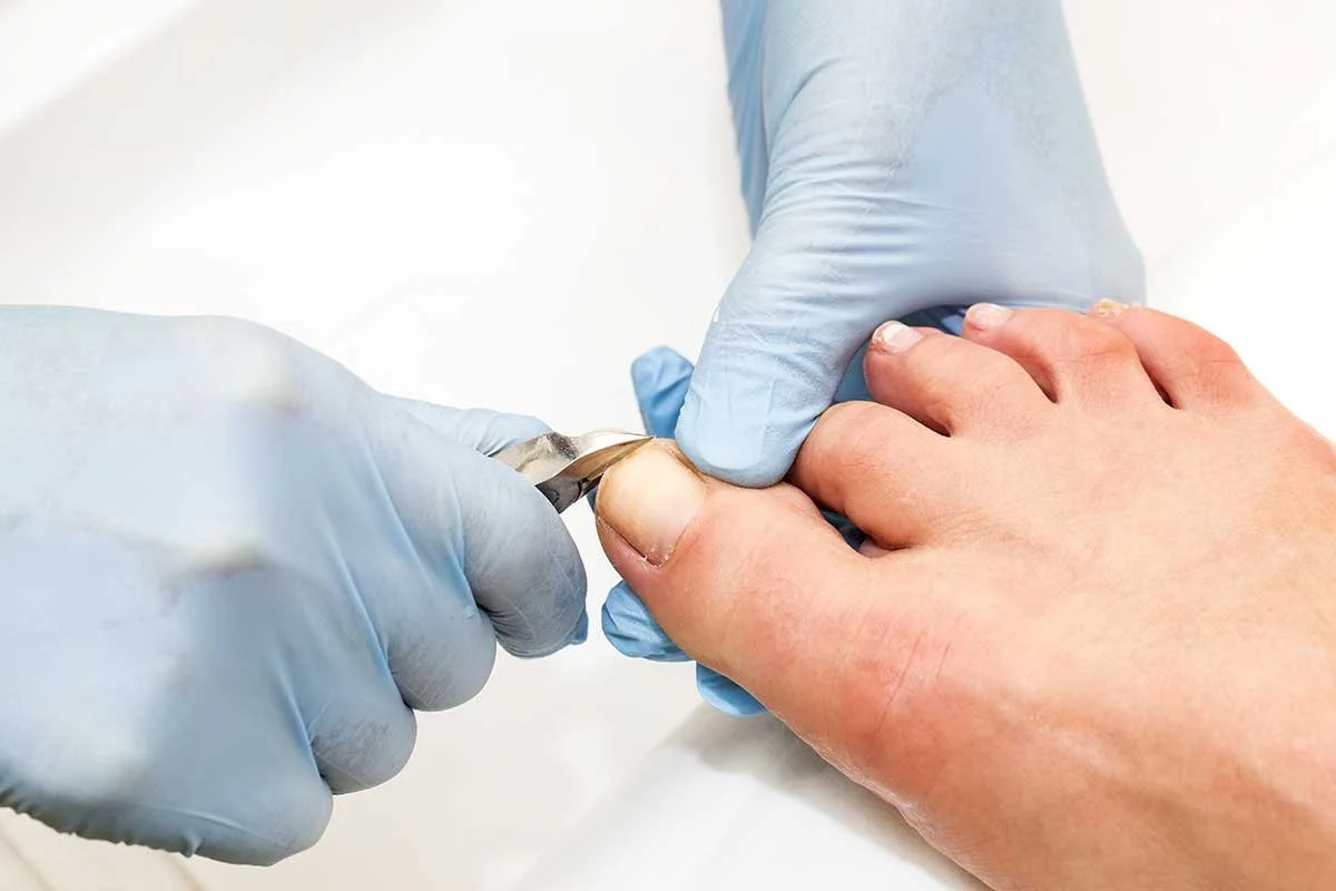 Un professionnel en gants effectue une manucure ou un soin des ongles sur un ongle du gros orteil d'une personne.