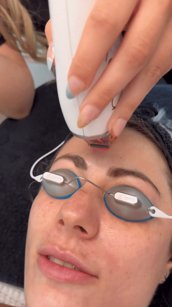 REV AESTHETICS MOXI SCITON REEL.gif