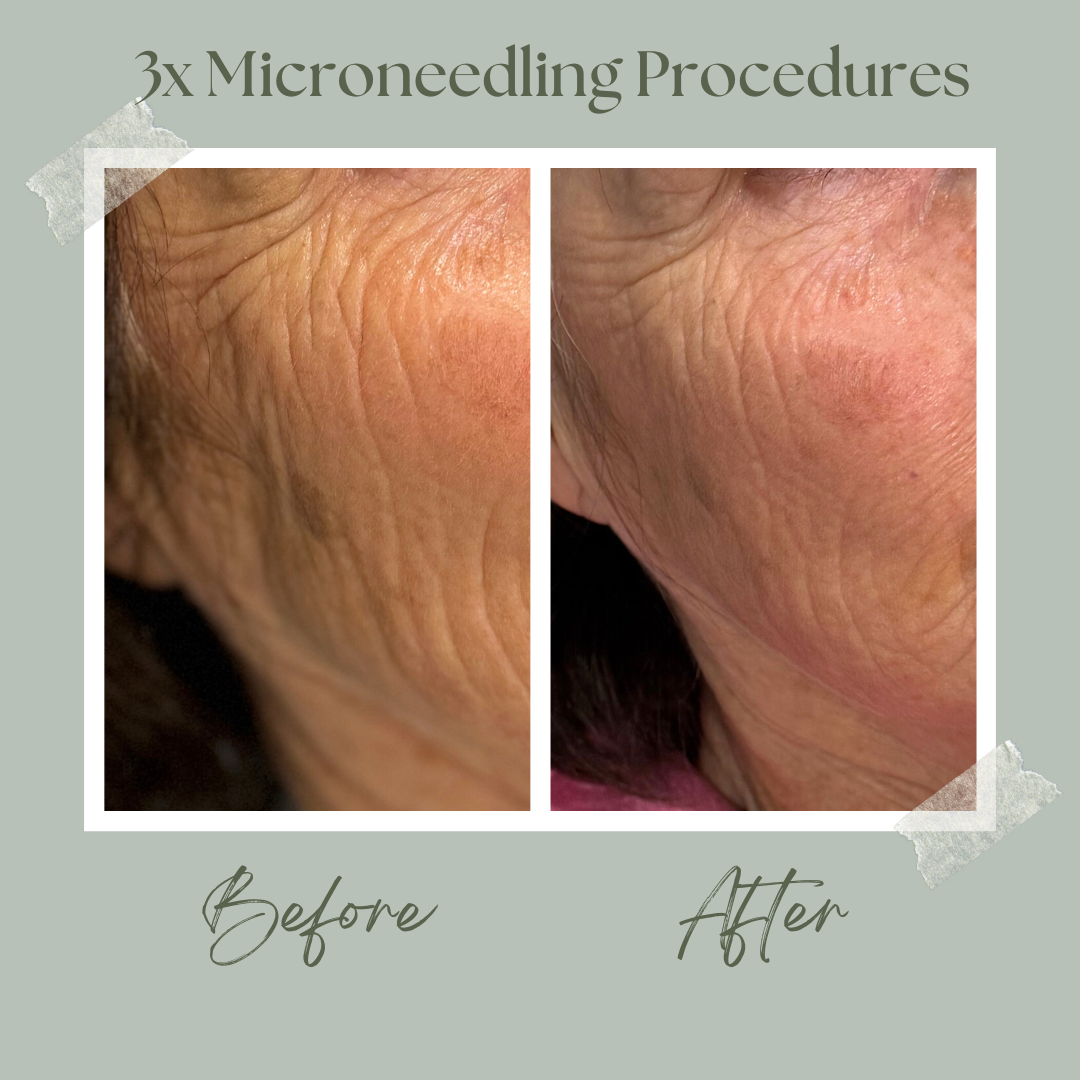 Mel Roberts Glow for Beauty Jennifer insta cheek.png