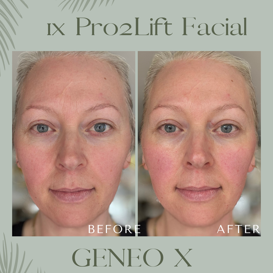 Grey Minimalist Before After Beauty Instagram Post.png