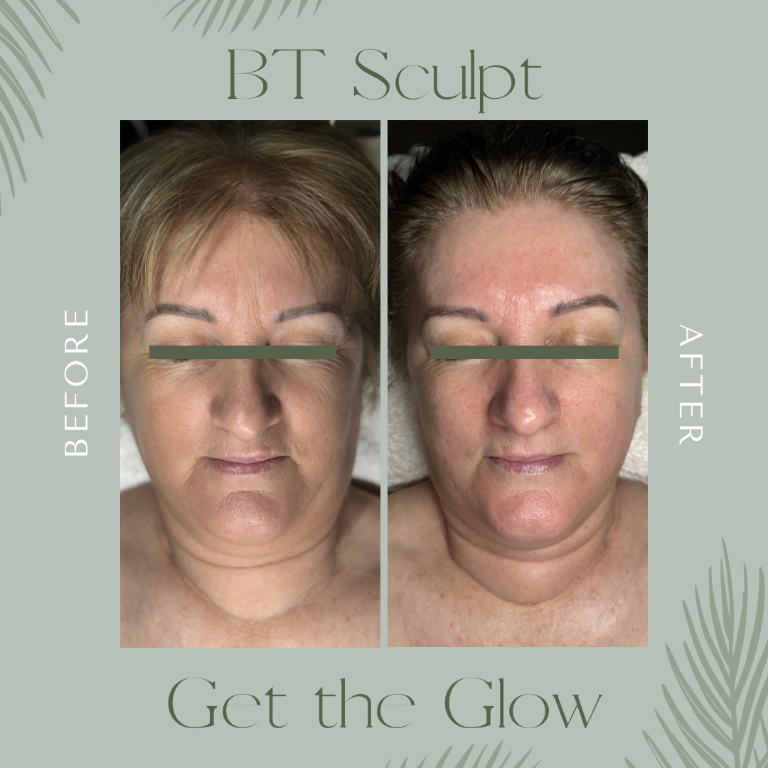 Mel Roberts Glow for Beauty Jenny Flagg Before after BT sculpt.png