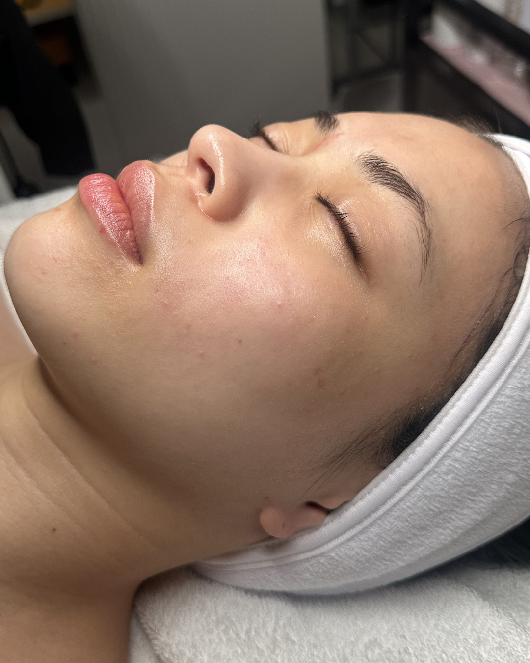 Click here if you’re receiving a Skin Treatment only