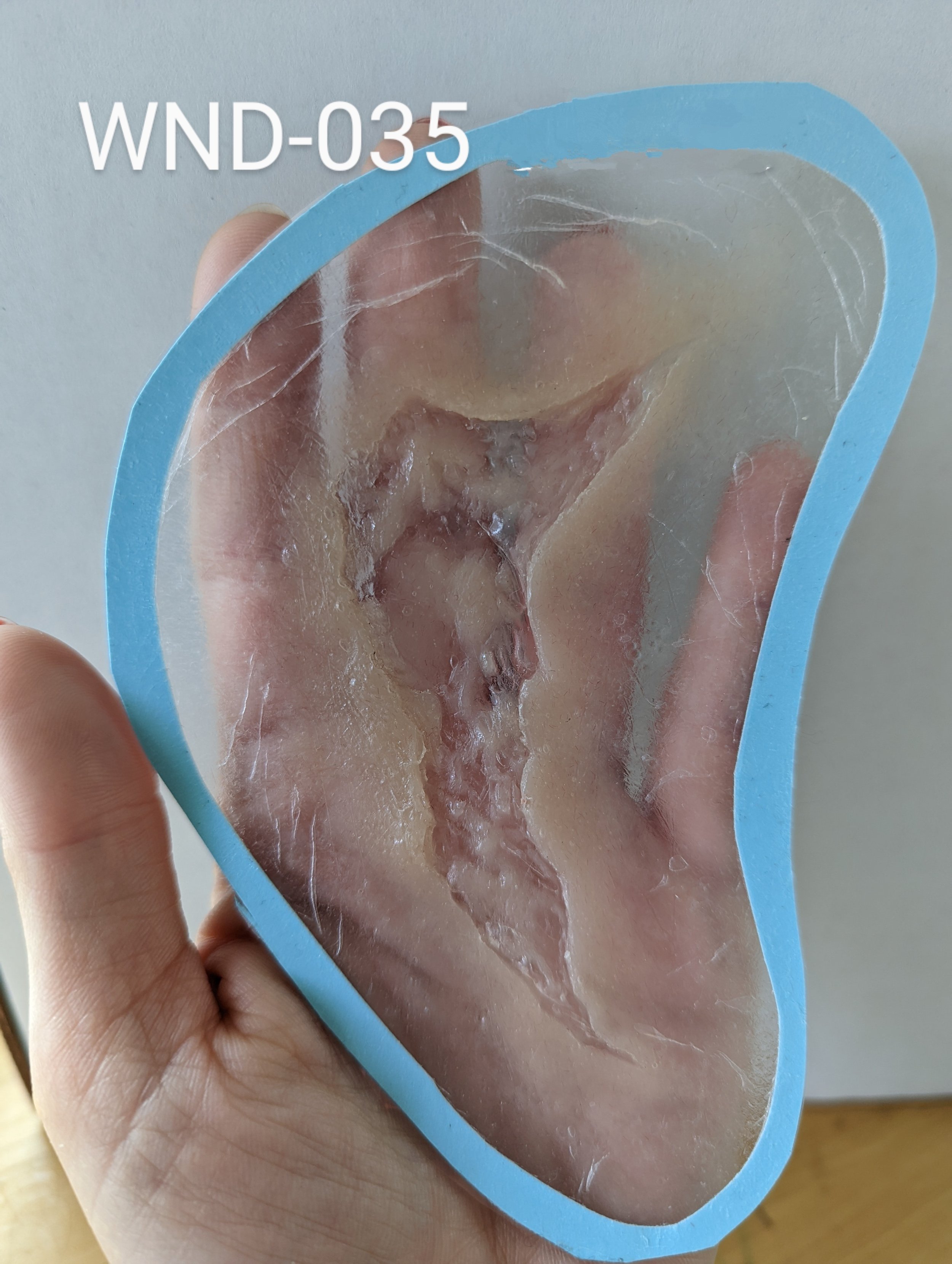 WND-035