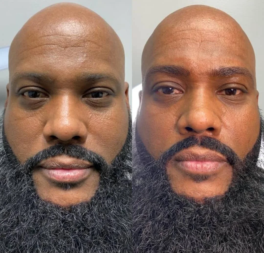 Eye Brow on Beard Man.jpeg