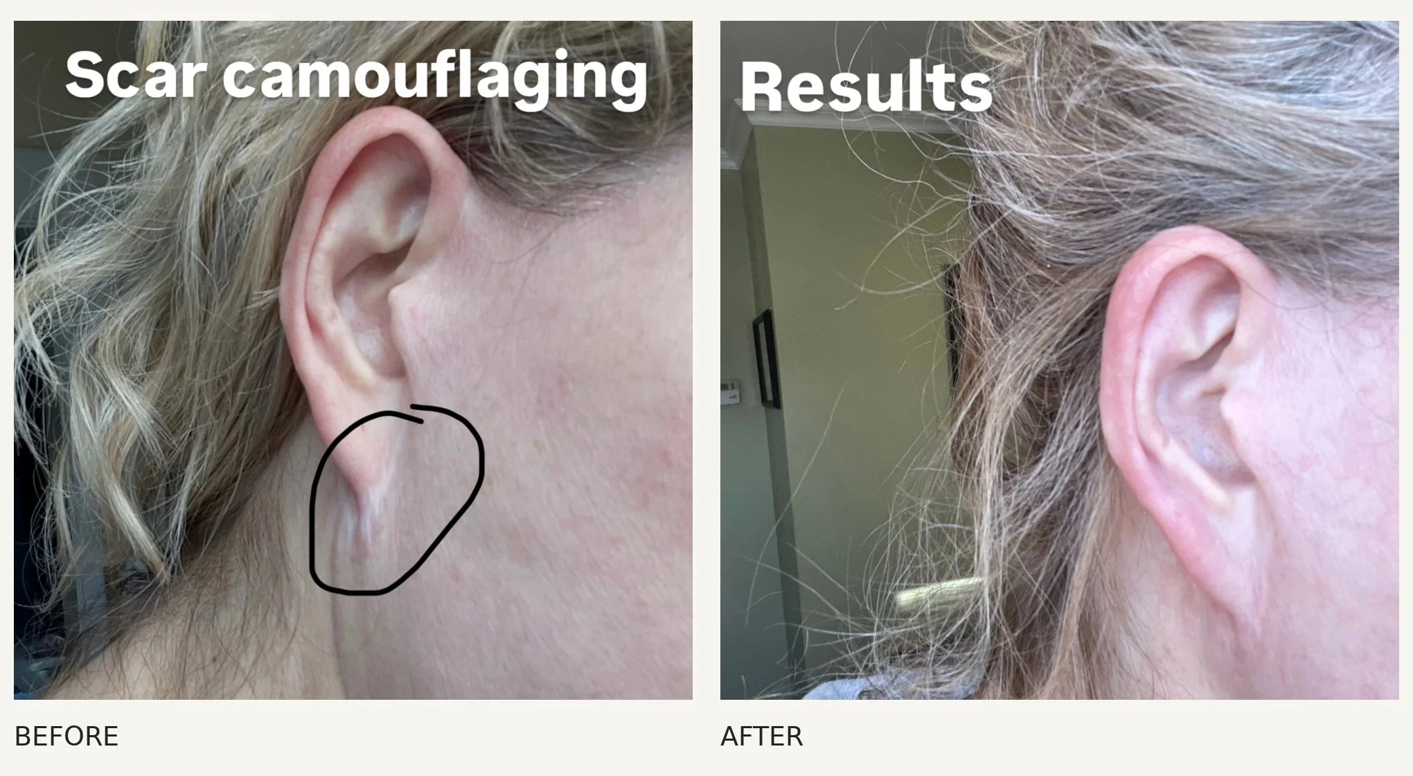 Scar camouflage · Before & After