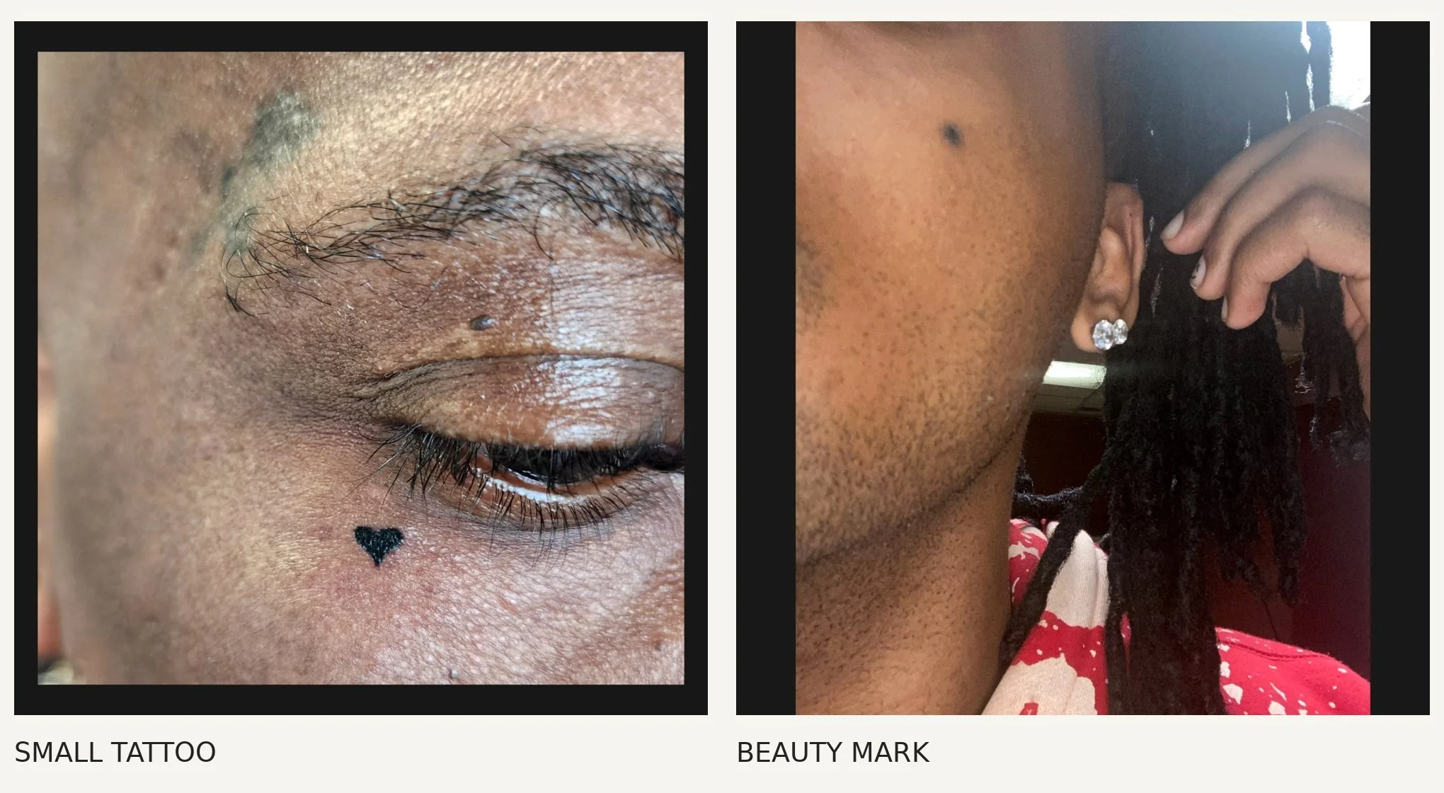 Small Tattoos & Beauty Marks · Examples