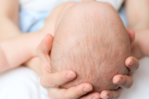 Plagiocephaly in Babies: How Physiotherapy Can Help