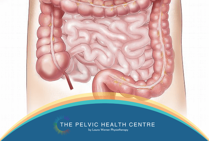 What is bowel-related pelvic floor dysfunction?