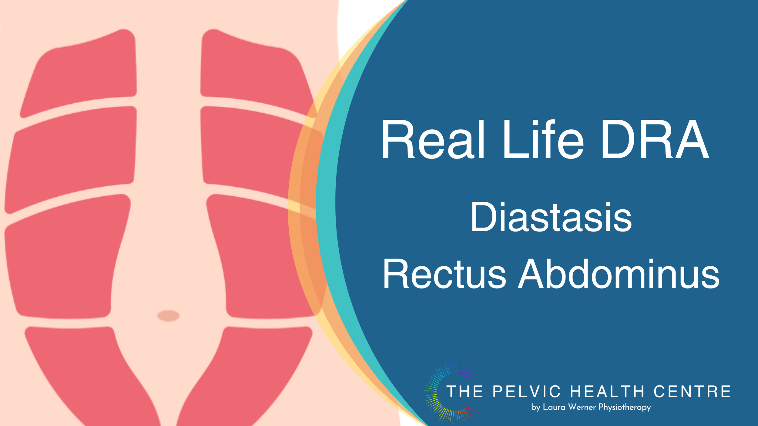 Physical therapy to heal rectus diastasis — New Journey Physical