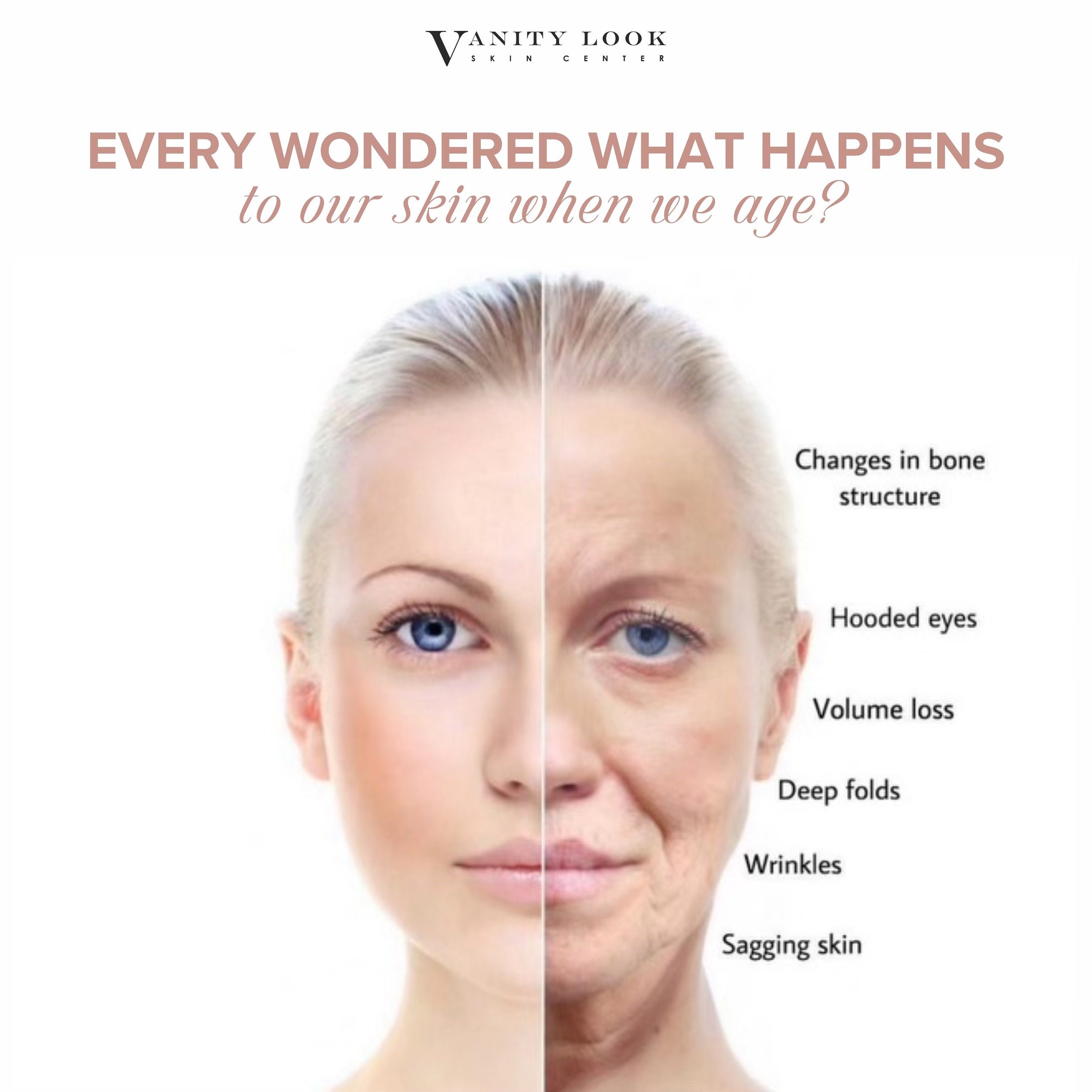 Ever wondered what happens to our face as we age? 🕰️ Over time, our skin undergoes changes: collagen production slows, elastin wears down, and fat in the deeper layers of our skin diminishes. This leads to wrinkles, sagging, and a loss of facial vol