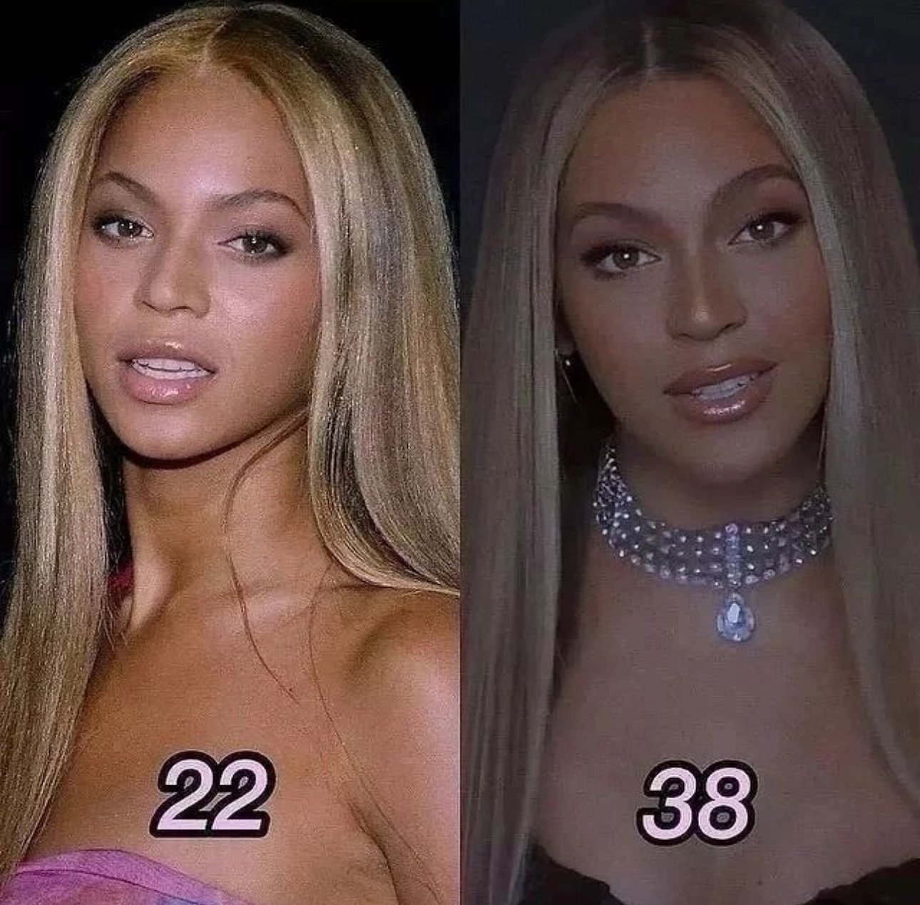 Beyonc&eacute; hasn&rsquo;t aged a day! What treatments do you think she gets any preventative treatments? 

Services we offer:
▪️ Fillers 
▪️ Anti-aging treatments
▪️ Facial Balancing
▪️ Laser Hair Removal
▪️ Skin Rejuvenation
▪️ Morpheus8 for face 