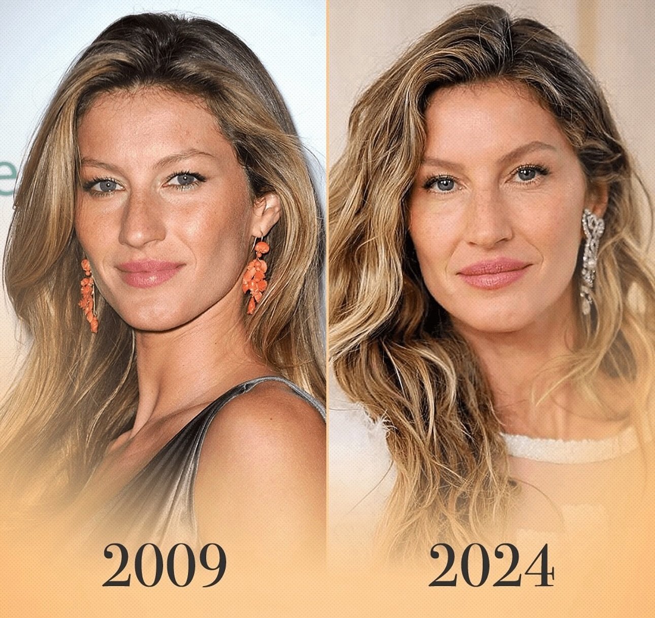 Gisele B&uuml;ndchen hasn&rsquo;t aged a day in 15 years! What do you think her top beauty secret is? ✨

Services we offer:
▪️ Fillers 
▪️ Anti-aging treatments
▪️ Facial Balancing
▪️ Laser Hair Removal
▪️ Skin Rejuvenation
▪️ Morpheus8 for face and 