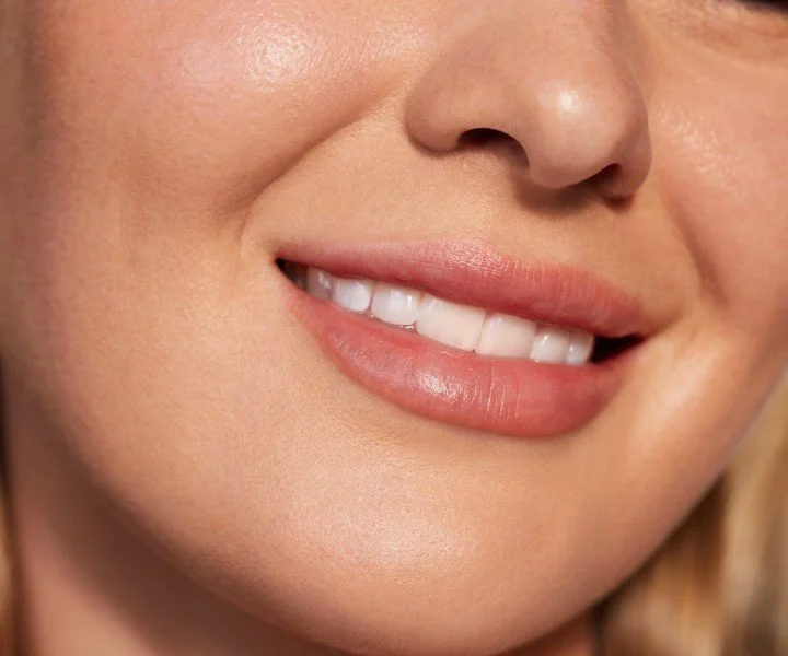 How Long Do Lip Fillers Last and How to Make Them Last Longer