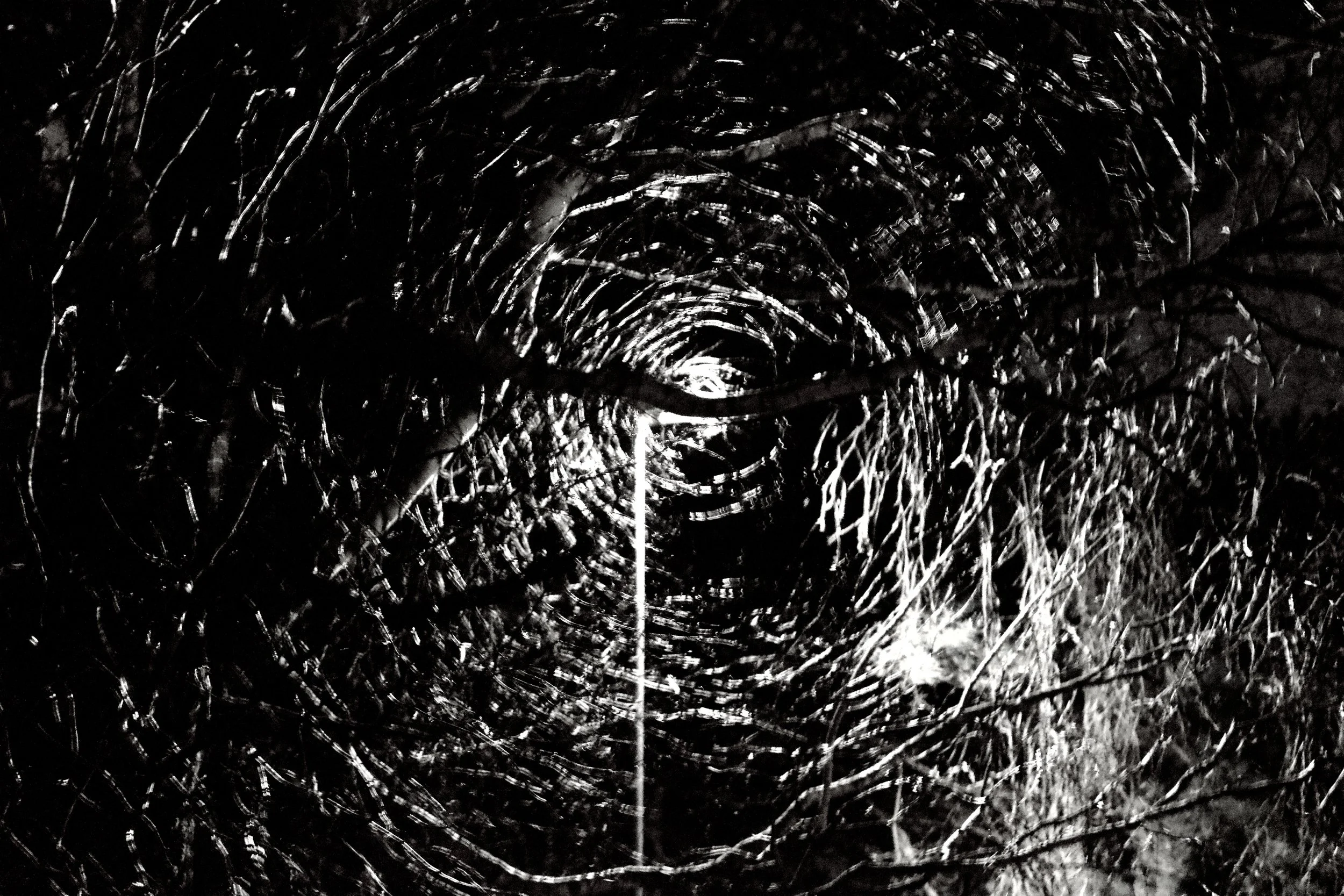 A close-up of a wound or injury with cracked and torn skin, showing an irregular black and white surface with shiny, reflective areas.