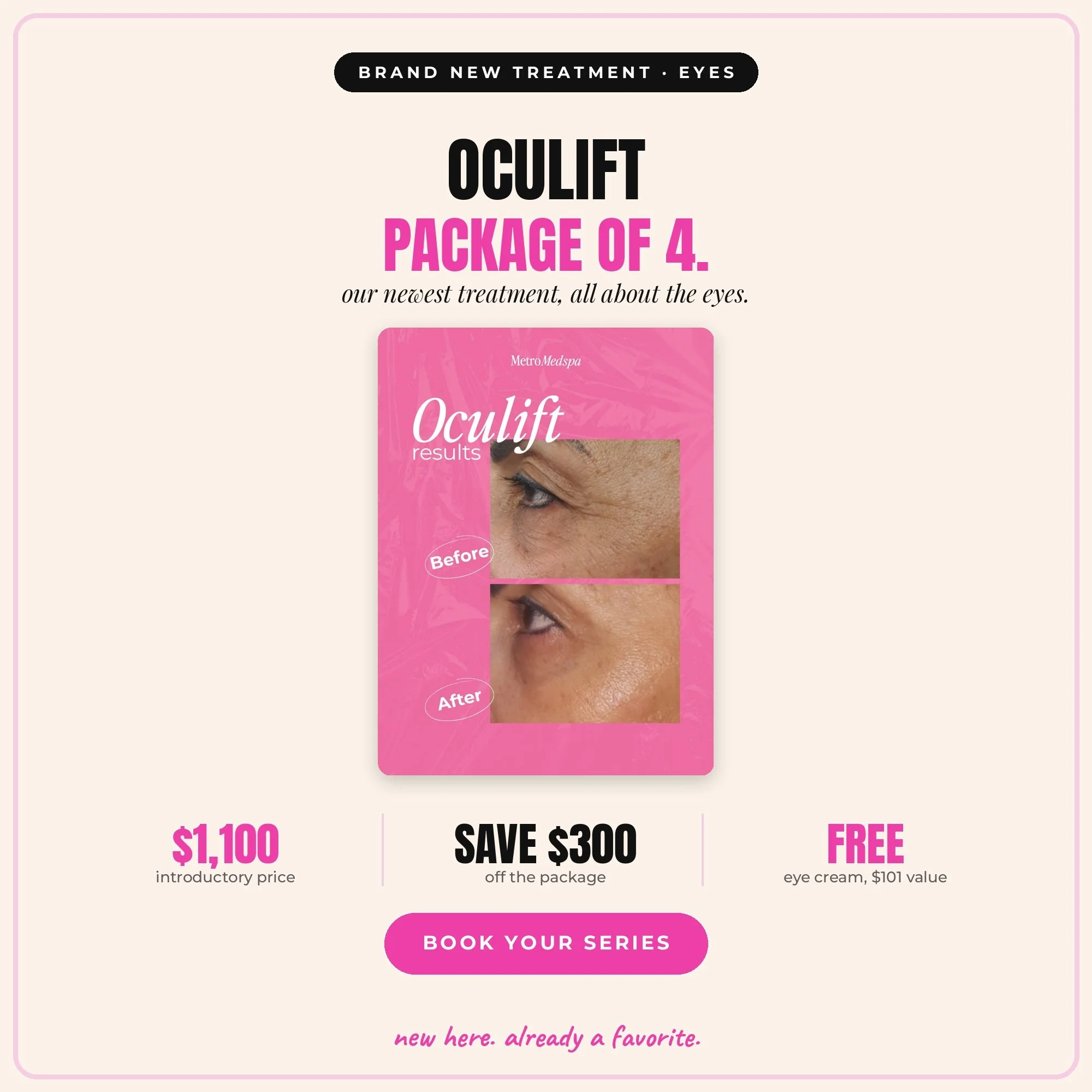OcuLift Launch Package | 4 Treatments + FREE Less Baggage Eye Cream