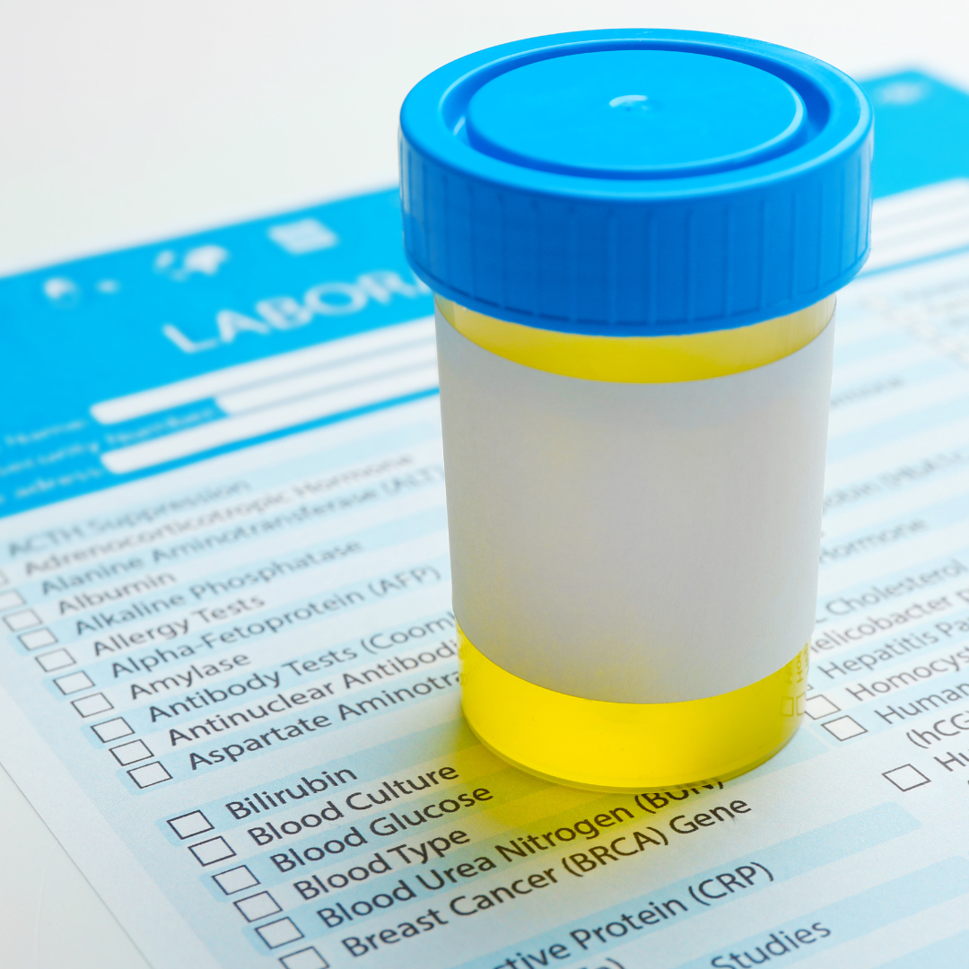 6 Reasons Why I Always Recommend Doing an Organic Acids Test (at least once!)