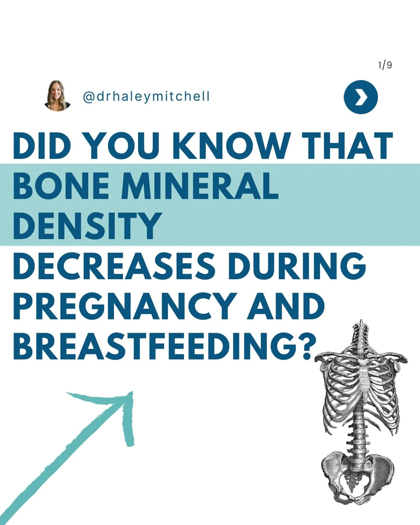 During pregnancy estrogen level increase significantly, and then drop rapidly after childbirth and remain repressed during the postpartum period. These levels can remain repressed throughout breastfeeding. 

Estrogen is a key regulator or bone densit