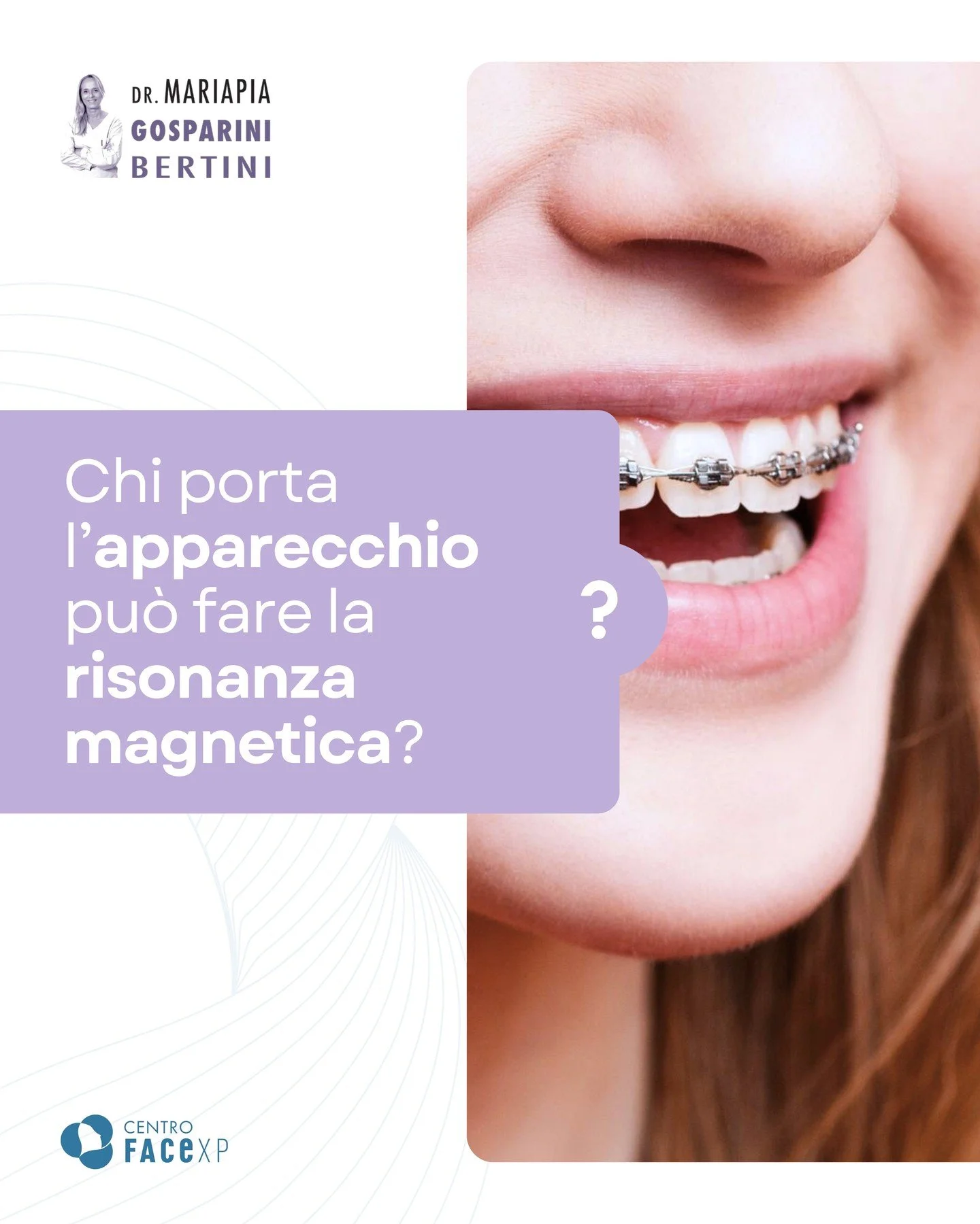 Dipende dal tipo di apparecchio!😃

L&rsquo;apparecchio fisso tradizionale può creare artefatti nelle immagini, specialmente se l&rsquo;esame riguarda testa e collo. 

Tuttavia, non rappresenta un pericolo per la salute.

Grazie ai progressi della t