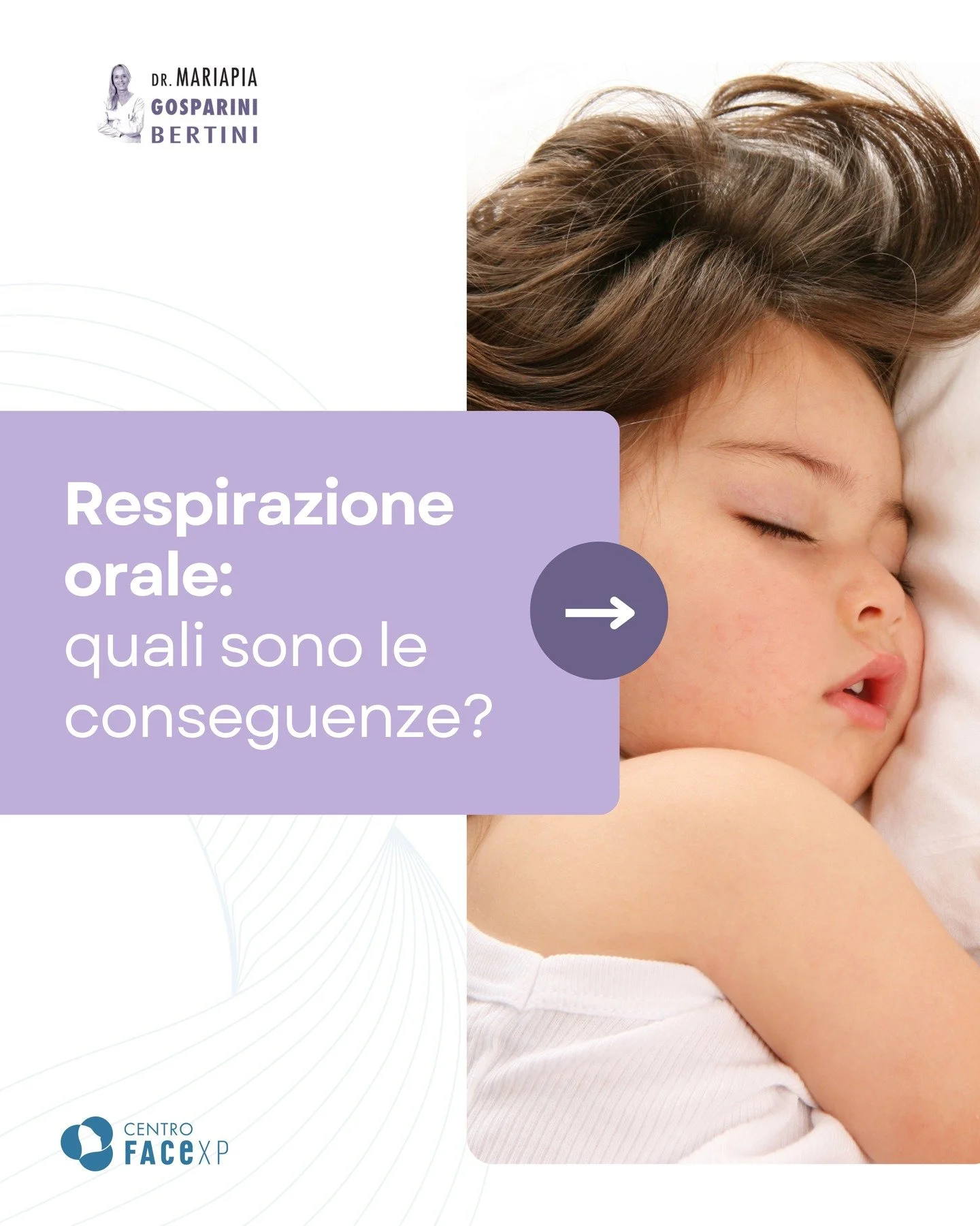 👦🏻🧒🏼 Il tuo bambino tiene la bocca aperta non solo mentre dorme ma anche durante il giorno? 

Quando le vie aeree sono ostruite, il piccolo &egrave; costretto a respirare attraverso la bocca. Questo
meccanismo, se protratto nel tempo, pu&ograve; 