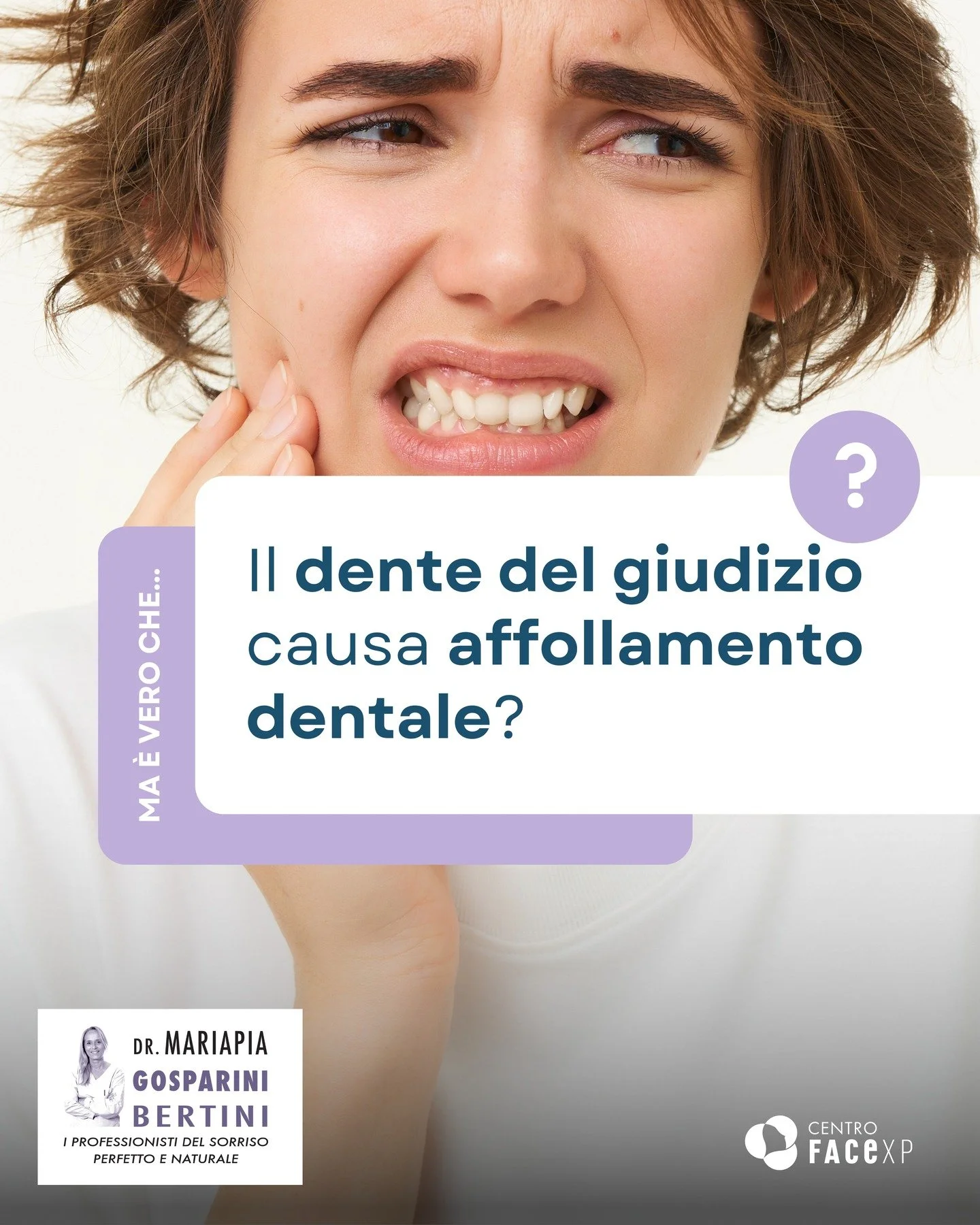 🦷 La nascita del dente del giudizio viene spesso indicata come causa del disallineamento dentale negli adulti.

❓❓Ma &egrave; davvero cos&igrave;? 

➡️ In realt&agrave;, l&rsquo;affollamento &egrave; solitamente il risultato di pi&ugrave; fattori.
C